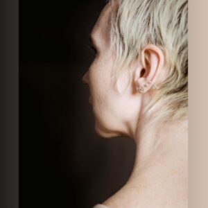 Cirurgia para corrigir furo de orelha