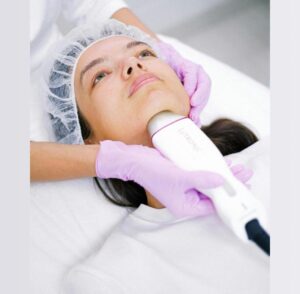 Laser dermatológico